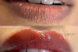 MAGNIVA AESTHETICS
