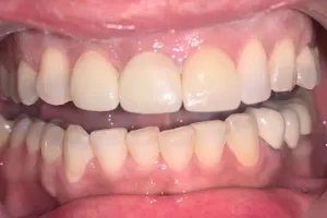 Perfect 32 Dental Care