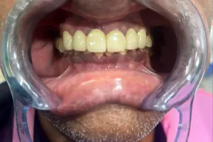 Rutu’s Dental Clinic &amp; Implant Centre