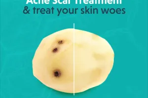 Oliva Skin, Hair &amp; Laser Clinic Aundh, Pune | Best Dermatologist In Pune For Skin Rejuvenation &amp; Hair Loss Treatments