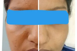 Skin World