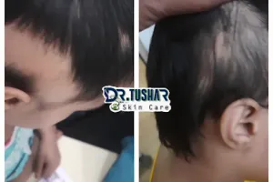 Dr.Tushar Jadhav Skin Care/Cure