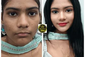 Sunshine Beauty &amp; Spa - Best Beauty Parlour | Ladies salon | Makeup artist | Nail &amp; spa in thane